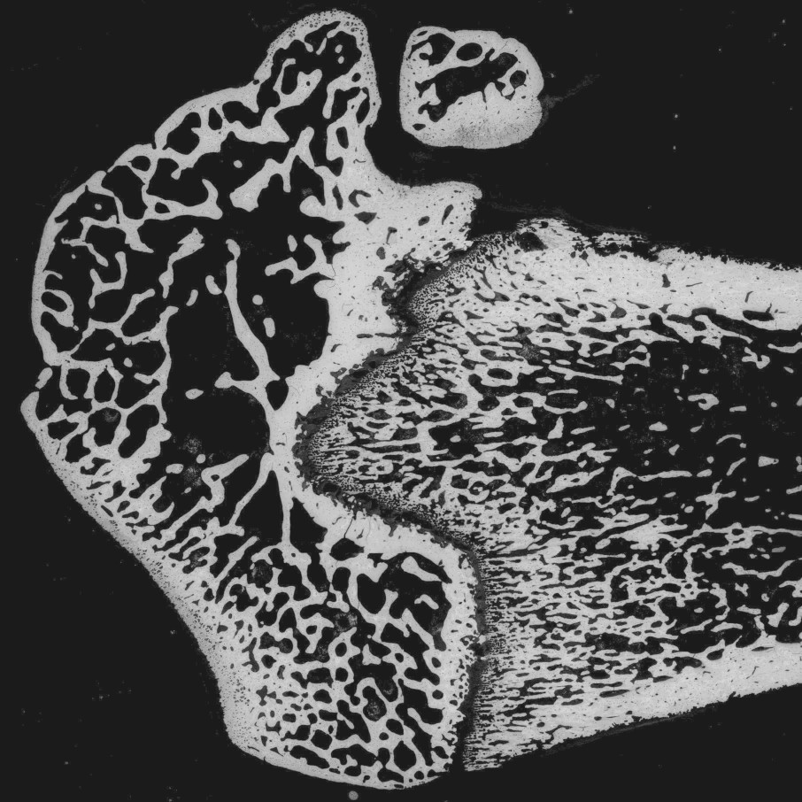 example image from biomedical research showing bone structure